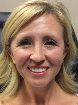 BOTOX Patient Before Photo Nashville