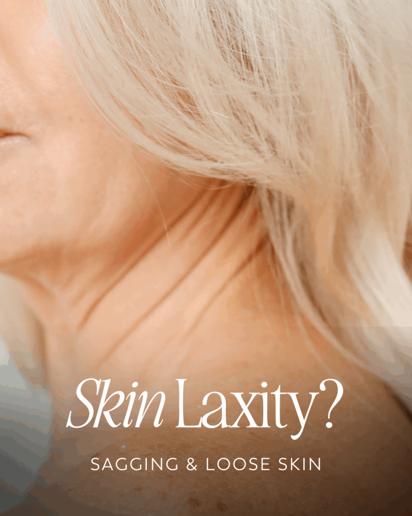 sagging skin and fine lines and wrinkles treatment options in brentwood