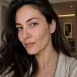 skin pen microneedling in franklin to help get rid of acne scars