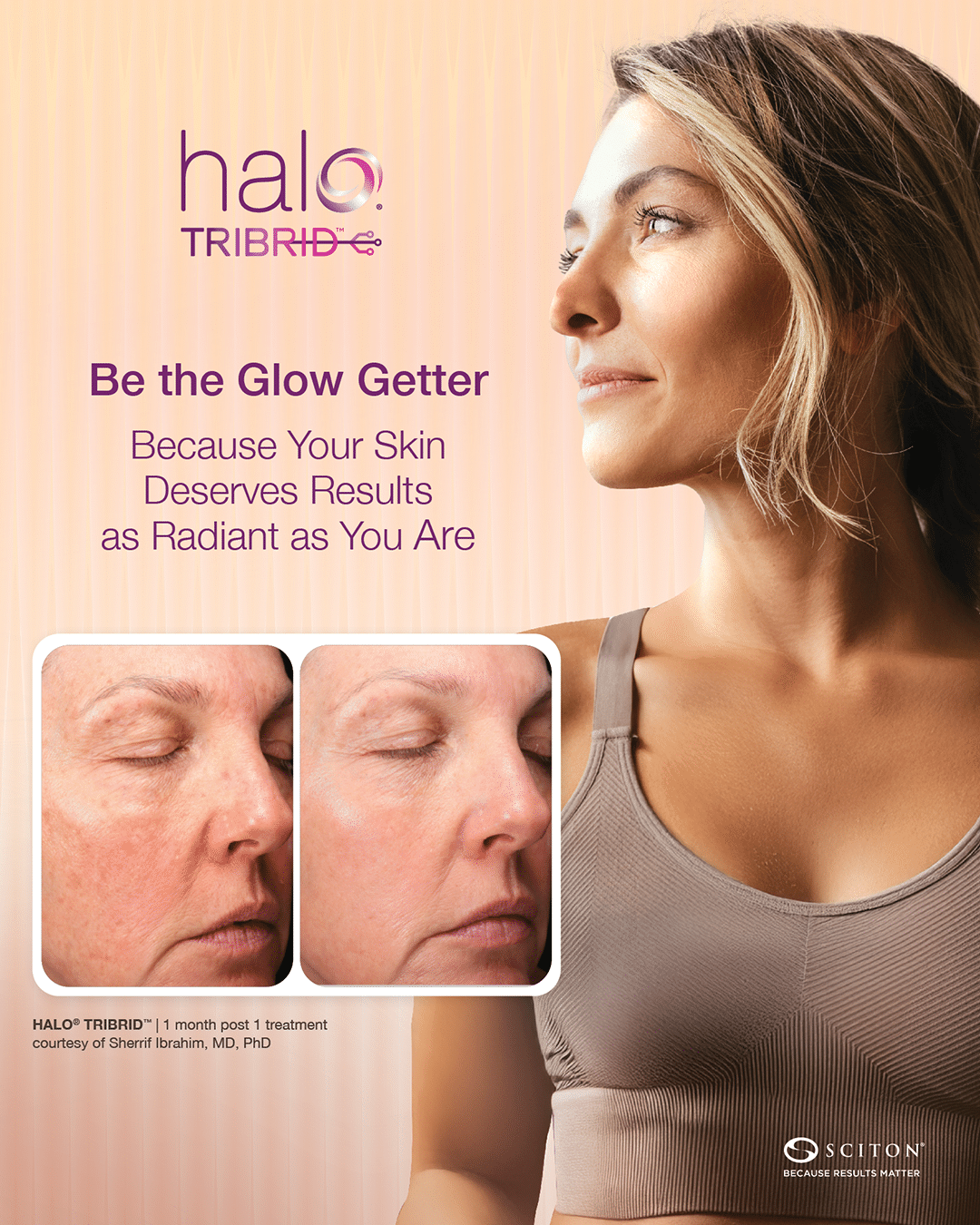 HALO TRIBRID promotional image, Be the Glow Getter, with before-and-after inset courtesy Sherrif Ibrahim, MD, PhD