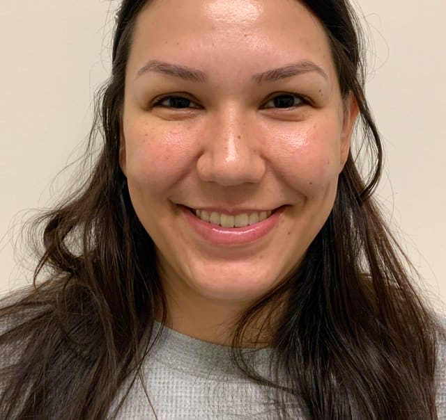 Botox after photo, softened crow’s feet while smiling — Case 94, Cool Springs Plastic Surgery, Brentwood TN