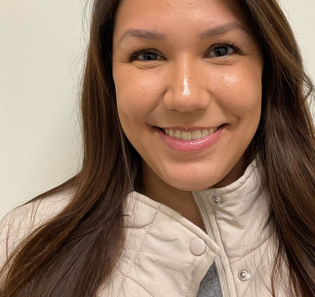 Botox before photo, crow’s feet while smiling — Case 94, Cool Springs Plastic Surgery, Brentwood TN