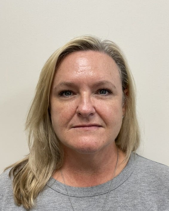 Before BBL laser treatment for sun damage and texture at Cool Springs Plastic Surgery in Nashville